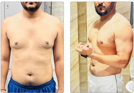 Suraj Malasi — before and after transformation with GetFittWithMohit